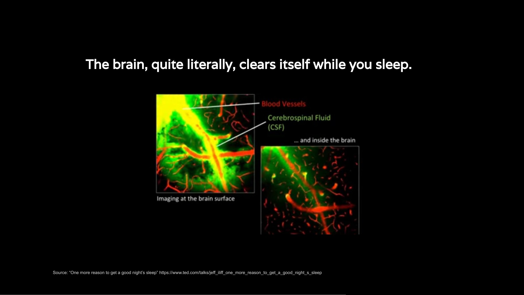 Imaging of the brain showing cerebrospinal fluid clearing waste, with the line: the brain, quite literally, clears itself while you sleep.